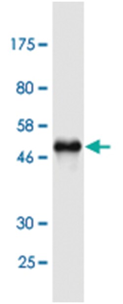 TIMP2, Mouse, Clone: 1C3, Abnova 200&mu;L; Unlabeled:Anticuerpos