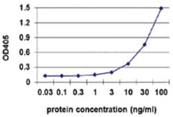 TK1, Human, Matched Antibody Pair (AP42), Abnova 1 Set:Antibodies