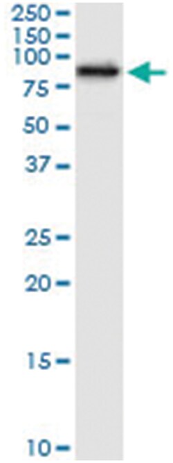 anti-TKT, Human, IP-WB Antibody Pair, Abnova&trade;