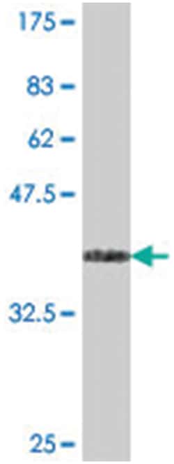 toll-like receptor 1, Mouse, Polyclonal Antibody, Abnova 50 &mu;L | Buy Online | Abnova | Fisher Scientific