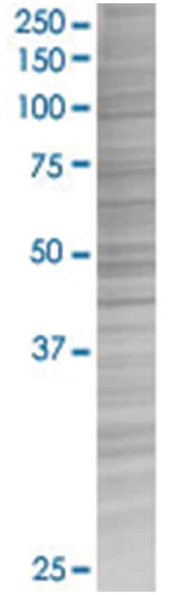 TLR2 293T Cell Overexpression Lysate (Denatured), Abnova 100 &mu;L | Buy Online | Abnova | Fisher Scientific