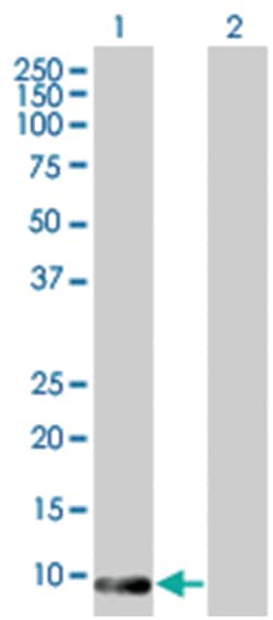 TMSB4X 293T Cell Overexpression Lysate (Denatured), Abnova 100 &mu;L | Buy Online | Abnova | Fisher Scientific
