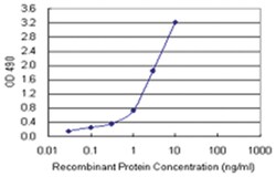 TNFRSF1B, Human, Matched Antibody Pair (AP42), Abnova™