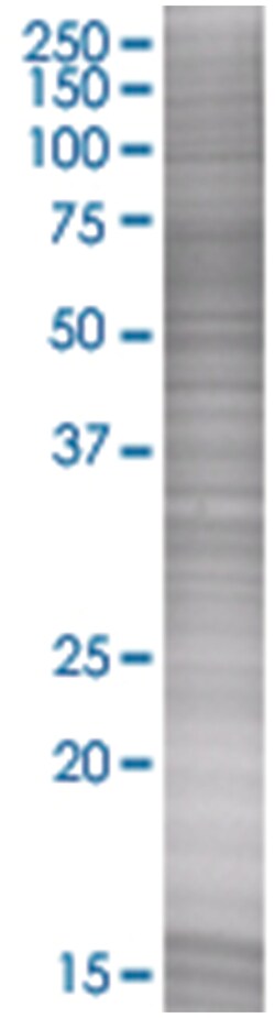 TNFRSF1B 293T Cell Overexpression Lysate (Denatured), Abnova 100 &mu;L | Buy Online | Abnova | Fisher Scientific