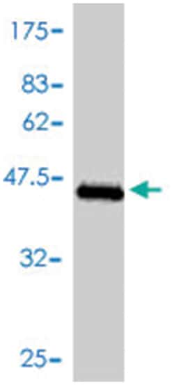 TNNC1, Mouse, Polyclonal Antibody, Abnova 50 &mu;L | Buy Online | Abnova | Fisher Scientific