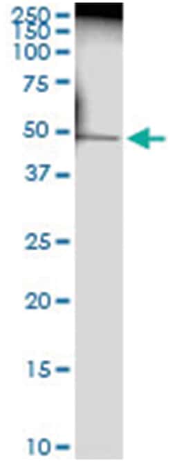 anti-TNNT2, Human, IP-WB Antibody Pair, Abnova 1 Set:Antibodies, Monoclonal/Polyclonal