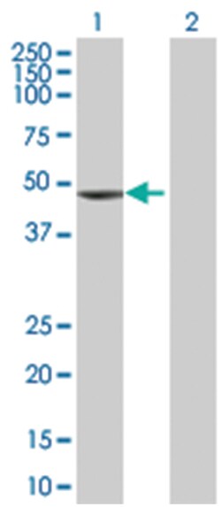 TNNT2 293T Cell Overexpression Lysate (Denatured), Abnova 100 &mu;L | Buy Online | Abnova | Fisher Scientific