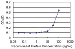 anti-TNXB Matched Antibody Pair, Abnova 1 set, Unlabeled:Antibodies, Monoclonal/Polyclonal