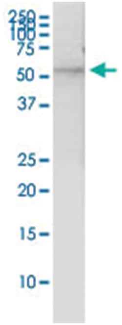 TP53, Human, IP-WB Antibody Pair (PW3), Abnova&trade;