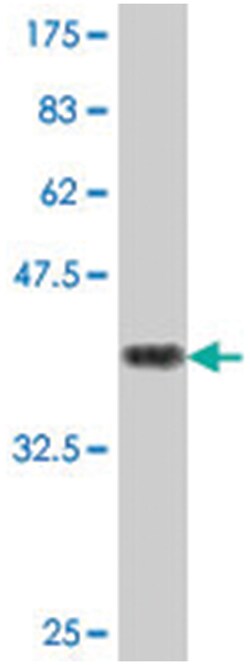 TPBG, Mouse, Polyclonal Antibody, Abnova 50&mu;L; Unlabeled:Antibodies,