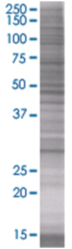 TPD52 293T Cell Overexpression Lysate (Denatured), Abnova 100 &mu;L | Buy Online | Abnova | Fisher Scientific