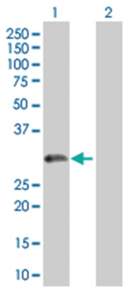 TPD52 293T Cell Overexpression Lysate (Denatured), Abnova 100 &mu;L | Buy Online | Abnova | Fisher Scientific
