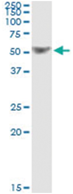 TRAF1, Human, IP-WB Antibody Pair (PW2), Abnova&trade;