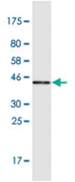TRAF6, Mouse, Clone: 1B2, Abnova 200&mu;L; Unlabeled:Antibodies, Monoclonal