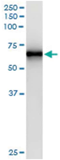anti-TRAF6, Human, IP-WB Antibody Pair, Abnova 1 Set:Antibodies, Monoclonal/Polyclonal