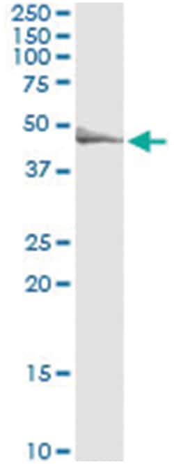 TRIP6, Human, IP-WB Antibody Pair (PW1), Abnova™