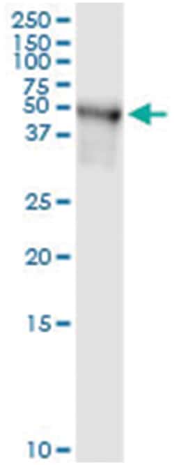 TRIP6, Human, IP-WB Antibody Pair (PW2), Abnova&trade;