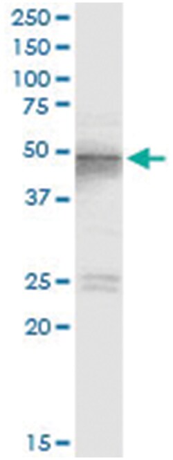 anti-TSG101, Human, IP-WB Antibody Pair, Abnova&trade;