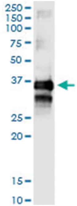 anti-TTC1, Human, IP-WB Antibody Pair, Abnova&trade;