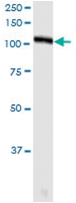 anti-TTK, Human, IP-WB Antibody Pair, Abnova&trade;
