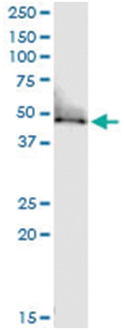 TUFM, Human, IP-WB Antibody Pair (PW1), Abnova&trade;