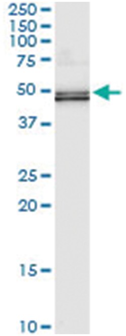 TUFM, Human, IP-WB Antibody Pair (PW2), Abnova 1 Set:Antibodies, Monoclonal/Polyclonal