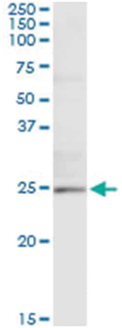TWIST1, Human, IP-WB Antibody Pair (PW2), Abnova&trade;