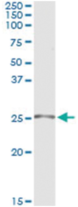 TWIST1, Human, IP-WB Antibody Pair (PW4), Abnova™