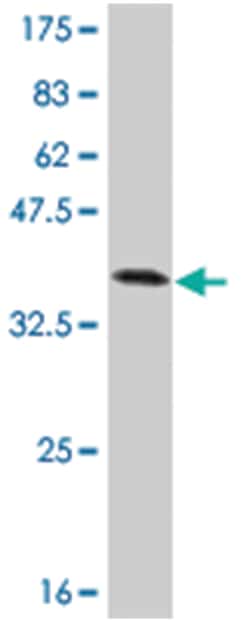 TXK tyrosine kinase, Mouse, Clone: 2G10, Abnova 100&mu;g; Unlabeled:Antibodies,