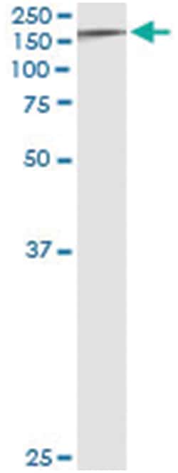 anti-TYK2, Human, IP-WB Antibody Pair, Abnova 1 Set:Antibodies, Monoclonal/Polyclonal