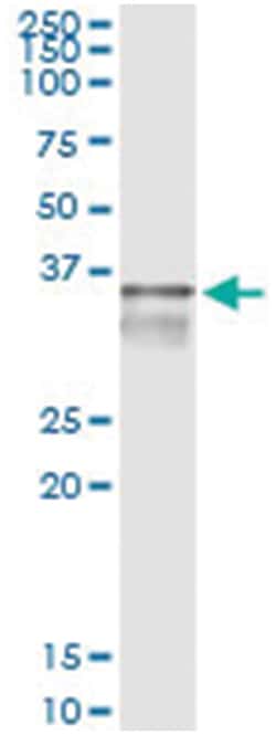 TYMS, Human, IP-WB Antibody Pair (PW2), Abnova&trade;