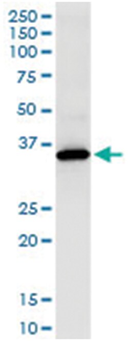 TYMS, Human, IP-WB Antibody Pair (PW3), Abnova&trade;
