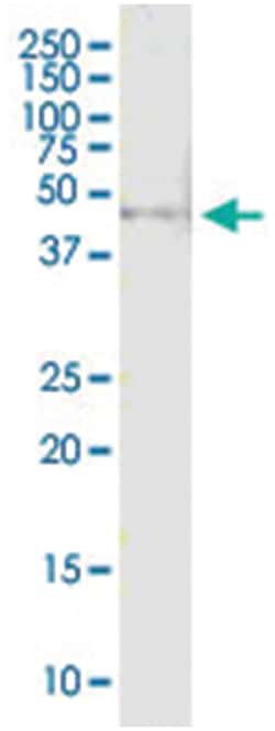 anti-TYR, Human, IP-WB Antibody Pair, Abnova&trade;