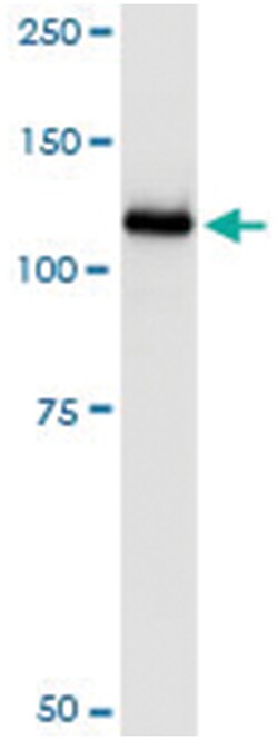 anti-UBA7, Human, IP-WB Antibody Pair, Abnova™