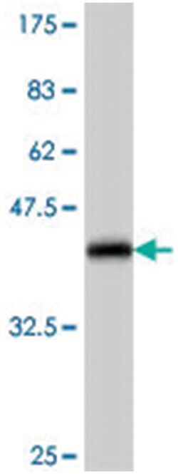 UBTF, Mouse, Polyclonal Antibody, Abnova 50 &mu;L | Buy Online | Abnova | Fisher Scientific
