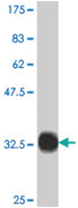 UCP1, Mouse, Polyclonal Antibody, Abnova 50 &mu;L | Buy Online | Abnova | Fisher Scientific