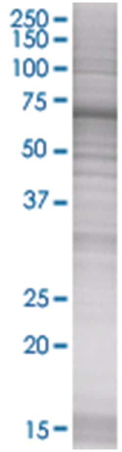 UCP2 293T Cell Overexpression Lysate 1 (Denatured), Abnova 100 &mu;L | Buy Online | Abnova | Fisher Scientific
