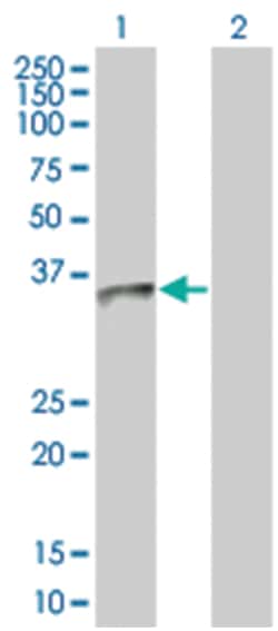 UCP2 293T Cell Overexpression Lysate 1 (Denatured), Abnova 100 &mu;L | Buy Online | Abnova | Fisher Scientific