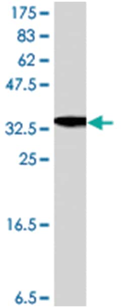 UDP-glucose ceramide glucosyltransferase, Mouse, Polyclonal Antibody, Abnova