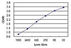 anti-UMOD Matched Antibody Pair, Abnova 1 set, Unlabeled:Antibodies, Monoclonal/Polyclonal