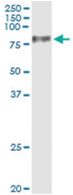 UMOD, Human, IP-WB Antibody Pair (PW2), Abnova&trade;