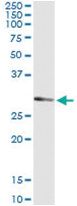 anti-UCK2, Human, IP-WB Antibody Pair, Abnova&trade;