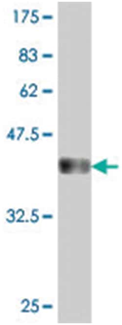 UPP1, Mouse, Polyclonal Antibody, Abnova 50&mu;L; Unlabeled:Antibodies,