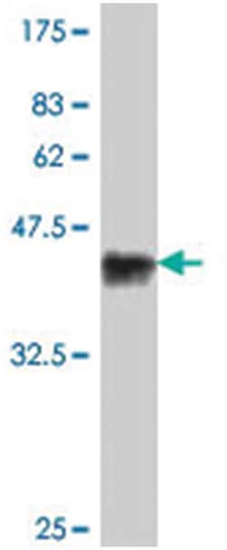 utrophin, Mouse, Polyclonal Antibody, Abnova 50 &mu;L | Buy Online | Abnova Corporation | Fisher Scientific