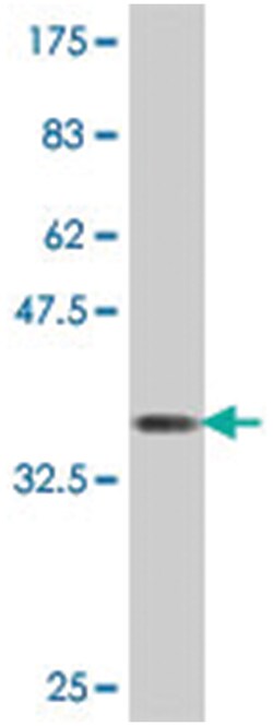 VARS, Mouse, Polyclonal Antibody, Abnova 50&mu;L; Unlabeled:Antibodies,