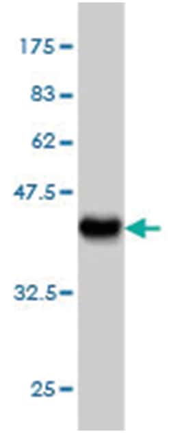 valyl-tRNA synthetase, Mouse, Clone: 4B7, Abnova 100 &mu;g | Buy Online | Abnova Corporation | Fisher Scientific