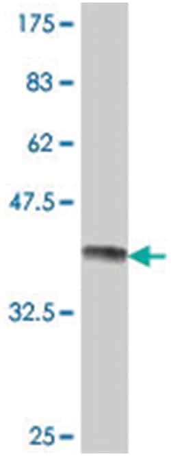 VHL, Mouse, Polyclonal Antibody, Abnova 50&mu;L; Unlabeled:Antibodies,