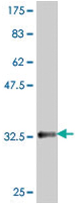 VIL1, Mouse, Polyclonal Antibody, Abnova 50&mu;L; Unlabeled:Antibodies,