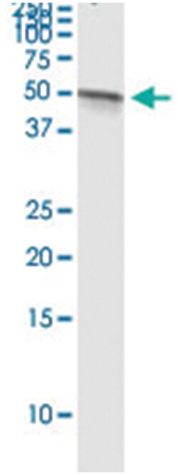 anti-VIL1, Human, IP-WB Antibody Pair, Abnova&trade;