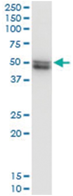 VRK1, Human, IP-WB Antibody Pair (PW2), Abnova 1 Set:Antibodies